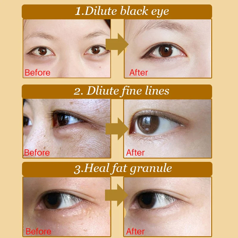 10pcs=5pair Black Collagen Eye Mask Crystal Eyelid Patch Anti Wrinkle Moisture - Image 25