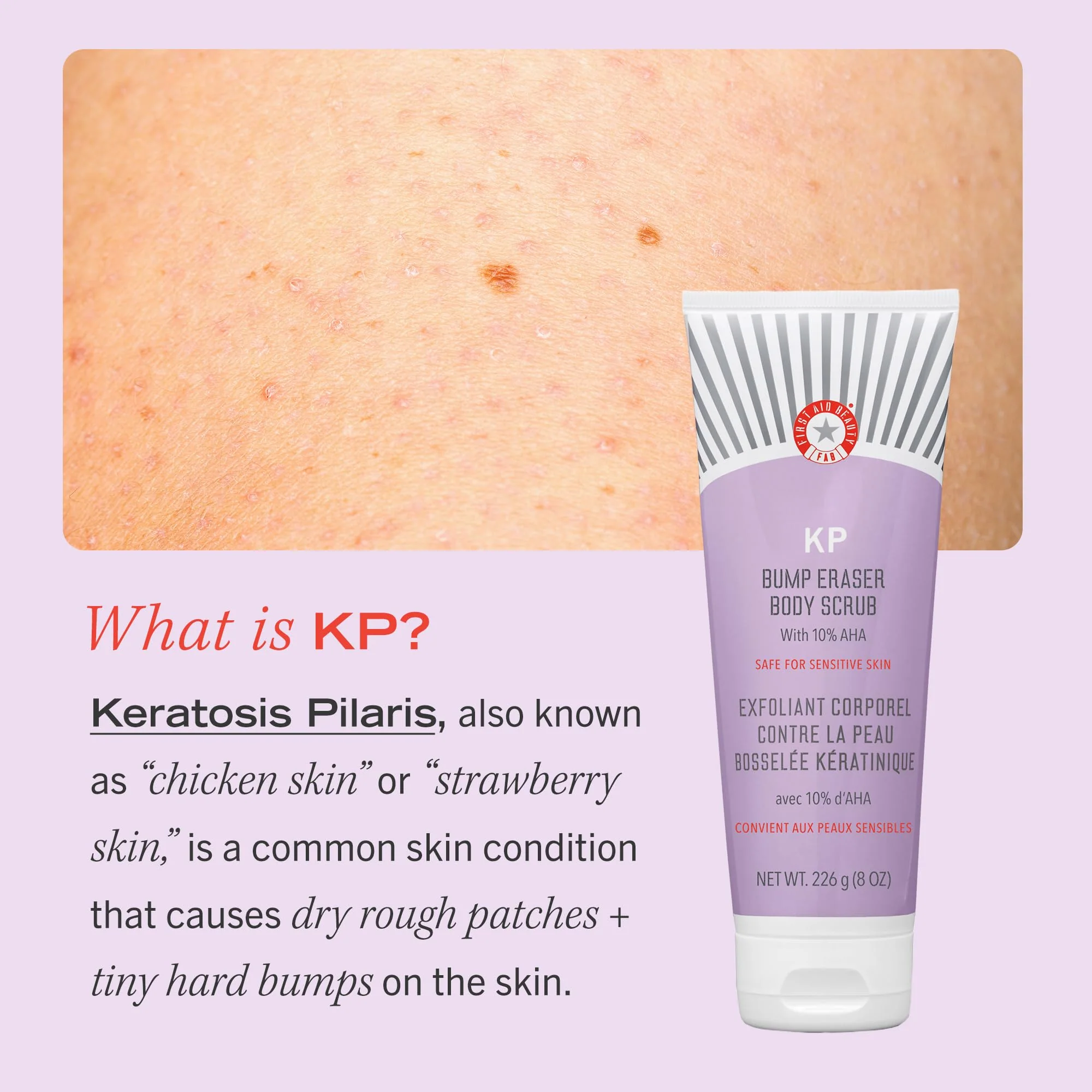 First Aid Beauty KP Bump Eraser Body Scrub Exfoliant for Keratosis Pilaris with 10% AHA 2 oz. - Image 5