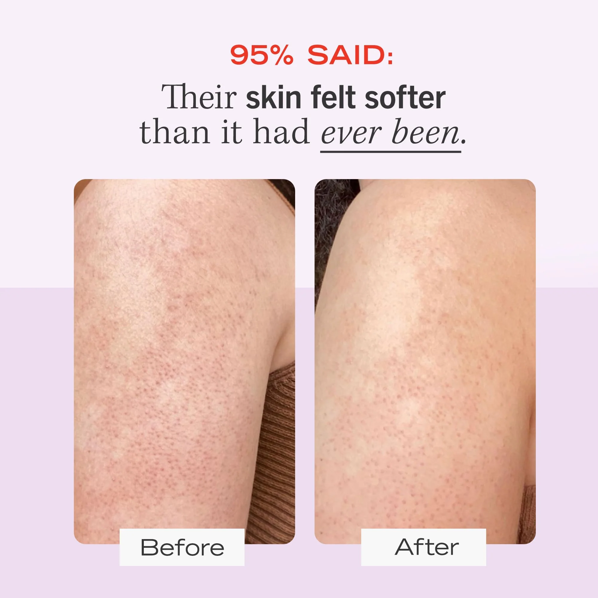 First Aid Beauty KP Bump Eraser Body Scrub Exfoliant for Keratosis Pilaris with 10% AHA 2 oz. - Image 8