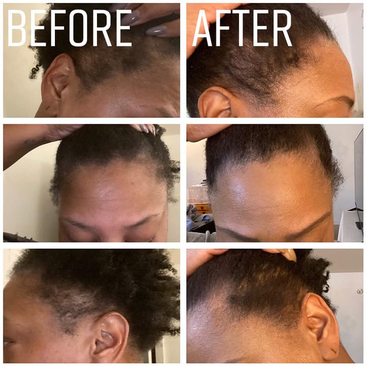 IQ Natural 4oz Unscented Jamaican Black Castor Oil for Hair Growth, Organic Cold Pressed Hexane Free, Black Women and Men, Dry Scalp Oil for Damaged Hair - Image 7