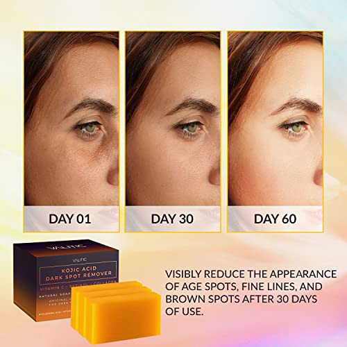 VALITIC Kojic Acid Dark Spot Remover Soap Bars with Vitamin C, Retinol, Collagen, Turmeric - Original Japanese Complex Infused with Hyaluronic Acid, Vitamin E, Shea Butter, Castile Olive Oil (3 Pack) - Image 6